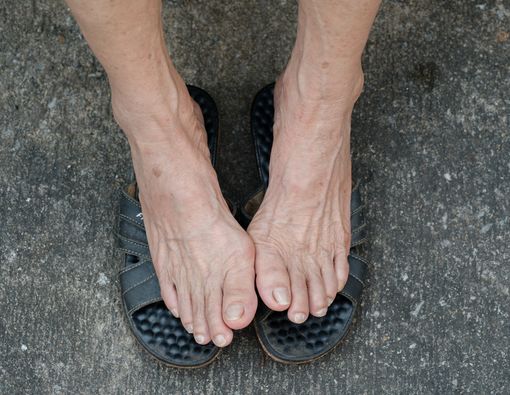 Kenali Gangguan Kesehatan pada Kaki Saat Lansia