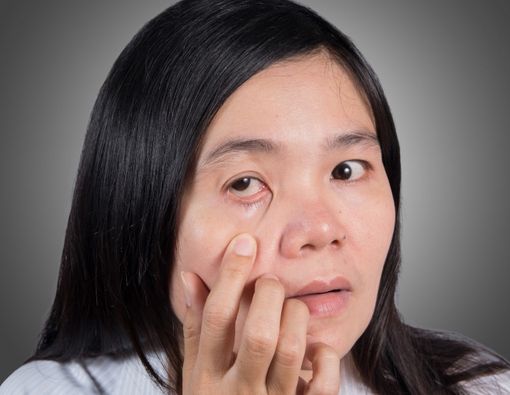 Waspada, Sakit Mata Bisa Jadi Gejala Tumor Otak