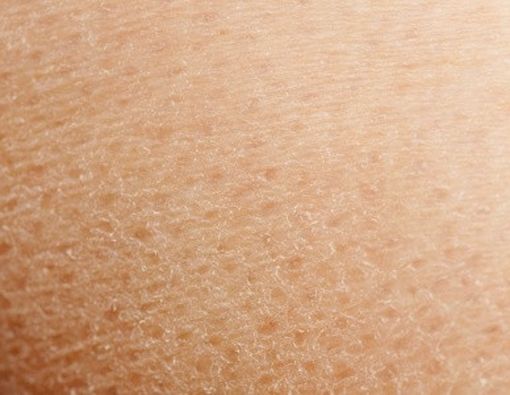 Kulit Kering? Jangan Didiamkan Saja!