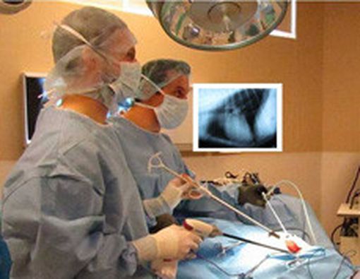 Pembedahan Invasif Minimal Harapan Baru Bagi Penderita Jantung
