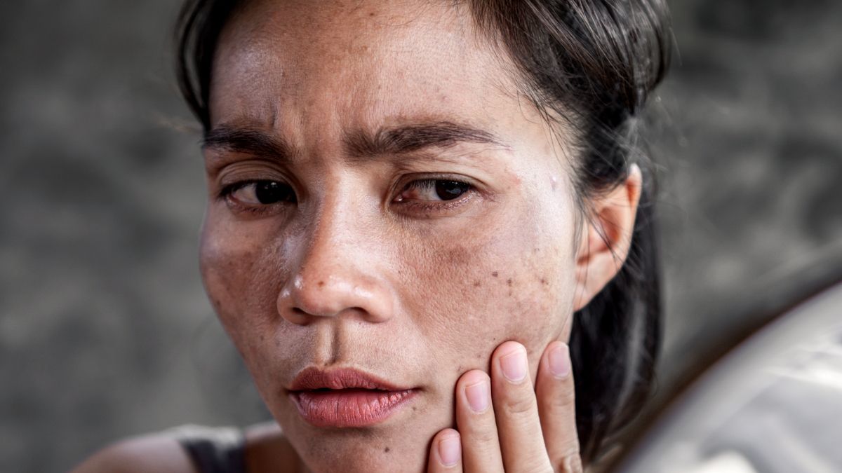 Mengapa Merkuri Pernah Jadi Bahan Skincare dan Bagaimana Cara Atasi Efek Sampingnya