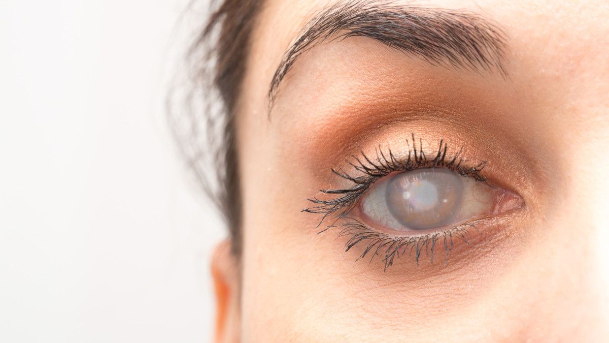 5 Tanda Tersembunyi Anda Terkena Katarak (Sruilk/Shutterstock)