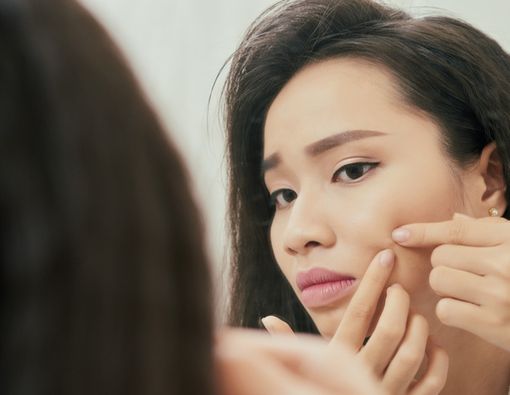 Terlanjur Pencet Jerawat? Segera Lakukan Hal Ini