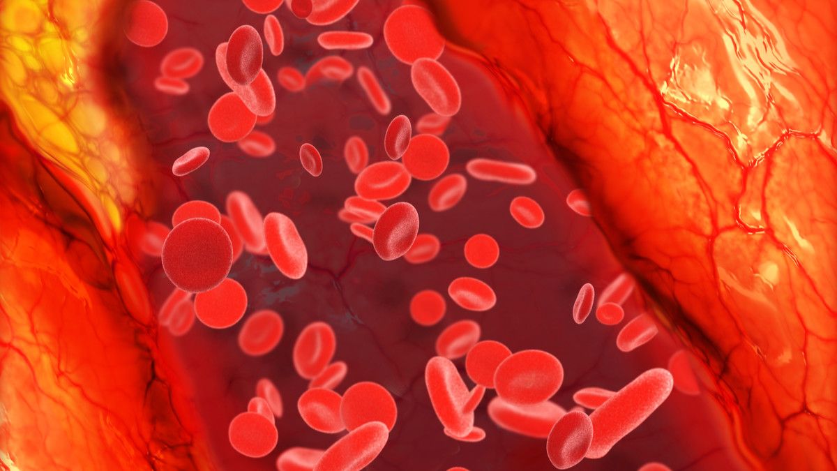 Awas, Jangan Sampai Kolesterol Naik Saat Lebaran!