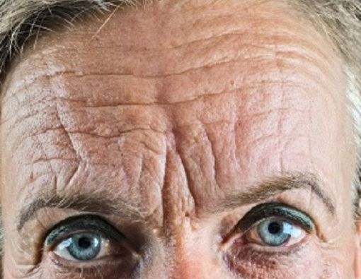 6 Hal Seputar Kerutan di Wajah
