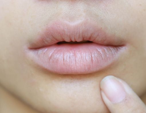 Jangan Menjilat Bibir Kering, Ini Alasannya