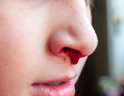 Pilihan Makanan untuk Anak yang Sering Mimisan