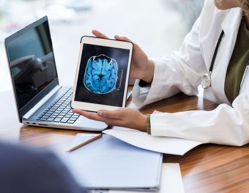 Kenali Penyebab Cerebral Atrophy, Kondisi yang Membuat Otak Menyusut