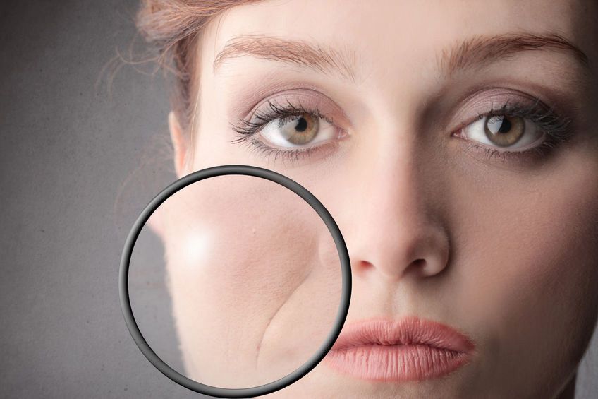 Usia Muda Tak Berarti Bebas Keriput