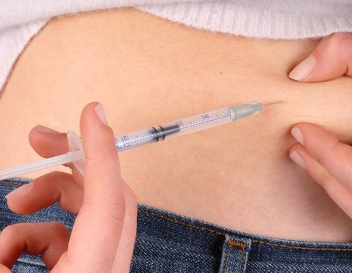 Bagian Tubuh yang Tepat untuk Disuntikkan Insulin
