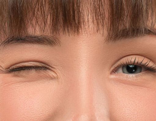 Mata Sering Kedutan? Ini Artinya dari Sisi Medis