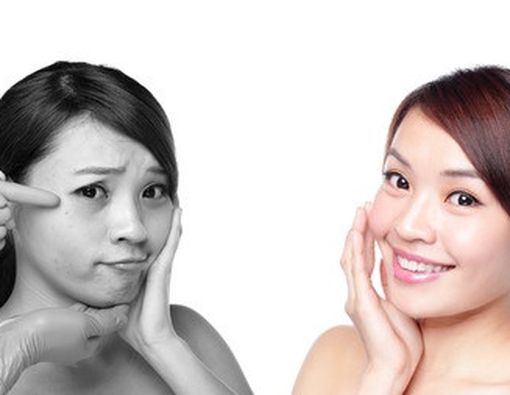 Mengapa Kulit Berkerut, Padahal Masih Muda?