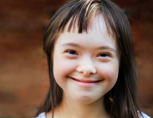 Mengapa Anak Down Syndrome Memiliki Wajah yang Khas?