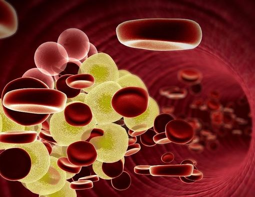 11 Daftar Penyakit yang Terkait Gangguan Kesehatan Pembuluh Darah