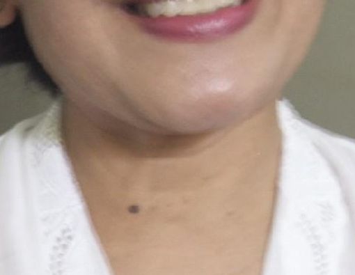 Herbal: Tak Kenal Maka Tak Sayang