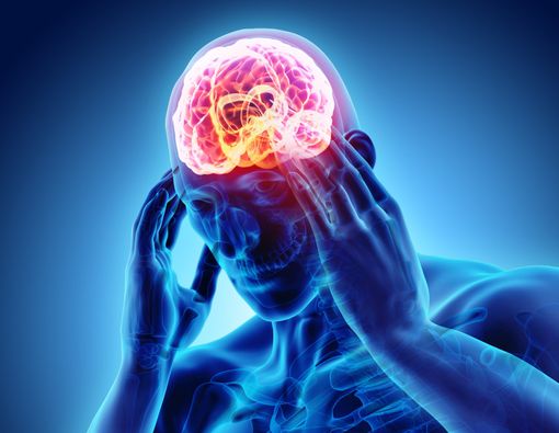 8 Fakta Seputar Nyeri Kepala Migrain
