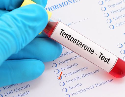 Tes Kadar Hormon Testosteron, Begini Prosedur dan Hasil Normalnya