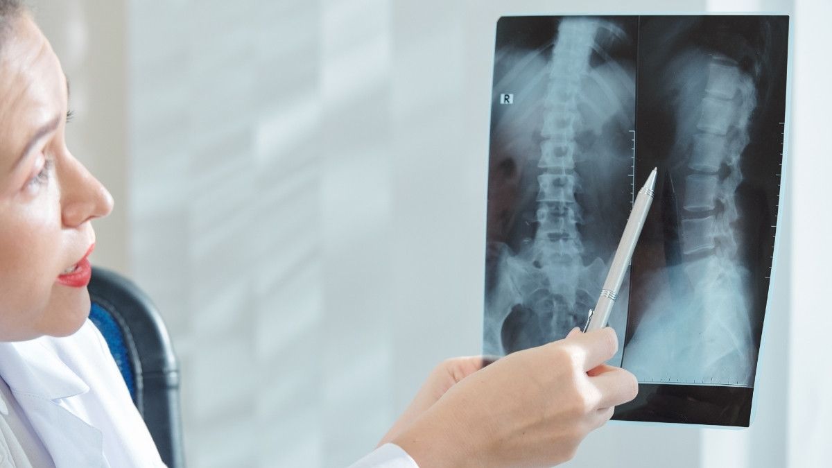 Vertebroplasty, Pengobatan Tulang Belakang Tanpa Operasi