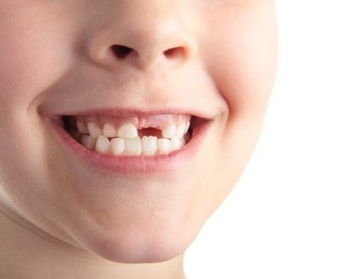 Gejala Penyakit Gigi yang Harus Diwaspadai