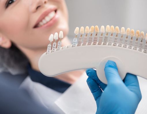 Benarkah Veneer Gigi Sebabkan Gigi Ngilu?