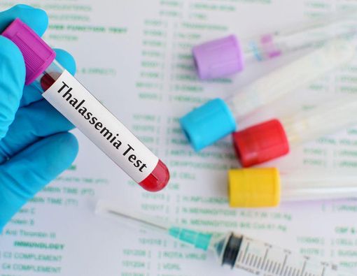 8 Pemeriksaan untuk Diagnosis Talasemia