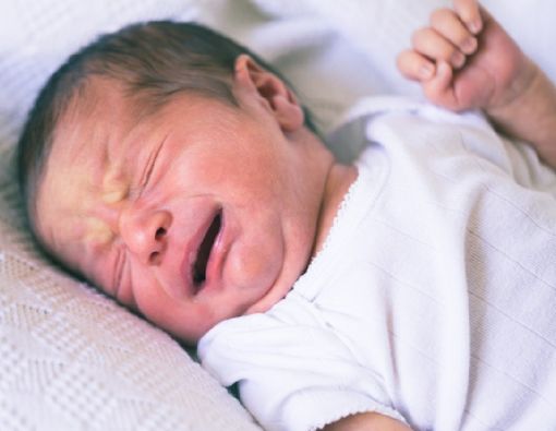 Sulit Minum Susu, Kenali Dampak Buruk Lip Tie pada Bayi