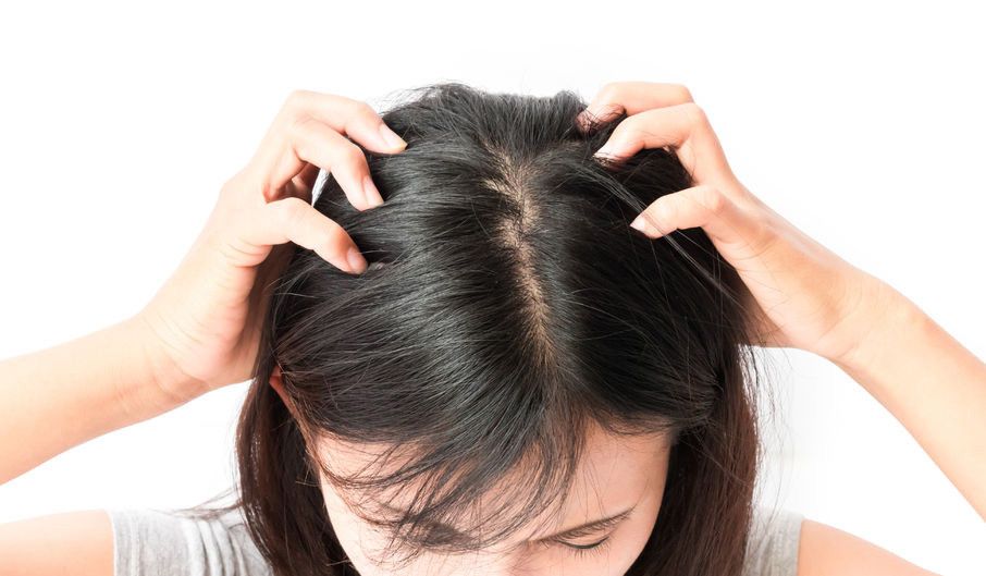 Fakta Tentang Kutu Rambut yang Anda Harus Tahu
