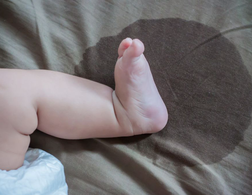 Cara Mengukur Jumlah Urine Normal pada Anak dan Bayi