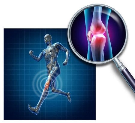 6 Mitos Tentang Osteoporosis