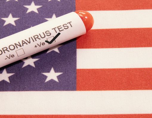 Prediksi Peneliti, 20 Juta Warga AS Positif Virus Corona!