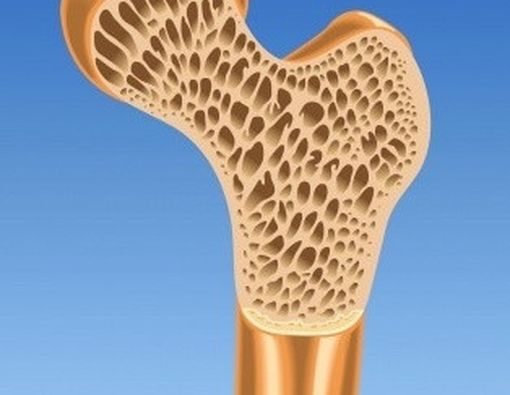 Bagaimana Osteoporosis Terjadi?