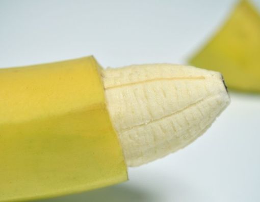 Sunat Ulang Akibat Potongan Kurang Presisi, Apa Maksudnya?