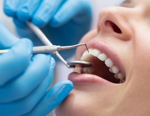 Gigi Berlubang, Segera Dicabut atau Cukup Dirawat?