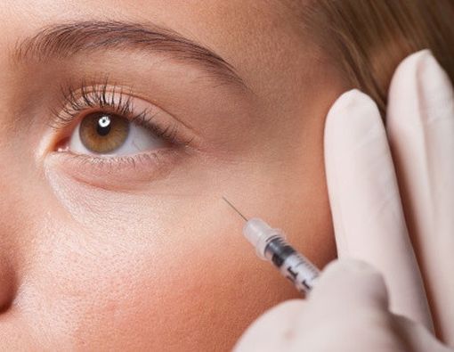 Semua yang Perlu Anda Tahu tentang Suntik Botox