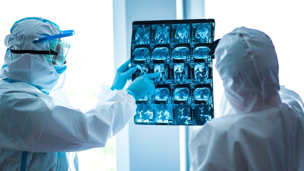 Wajib Tahu, Ini Organ Tubuh yang Terdampak Virus Corona