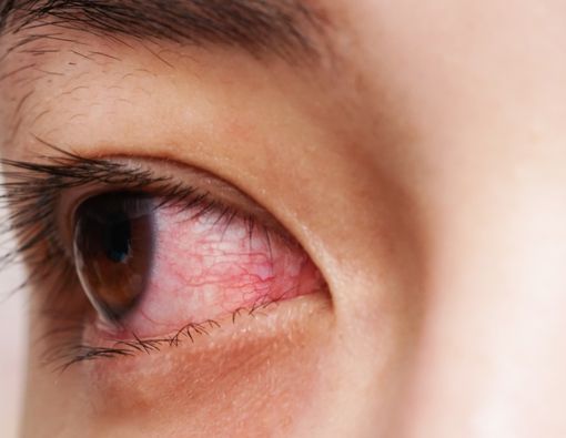 Perhatikan, Ini 5 Gejala Virus Corona yang Tidak Biasa