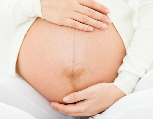 Penjelasan Garis Perut atau Linea Nigra pada Ibu Hamil 