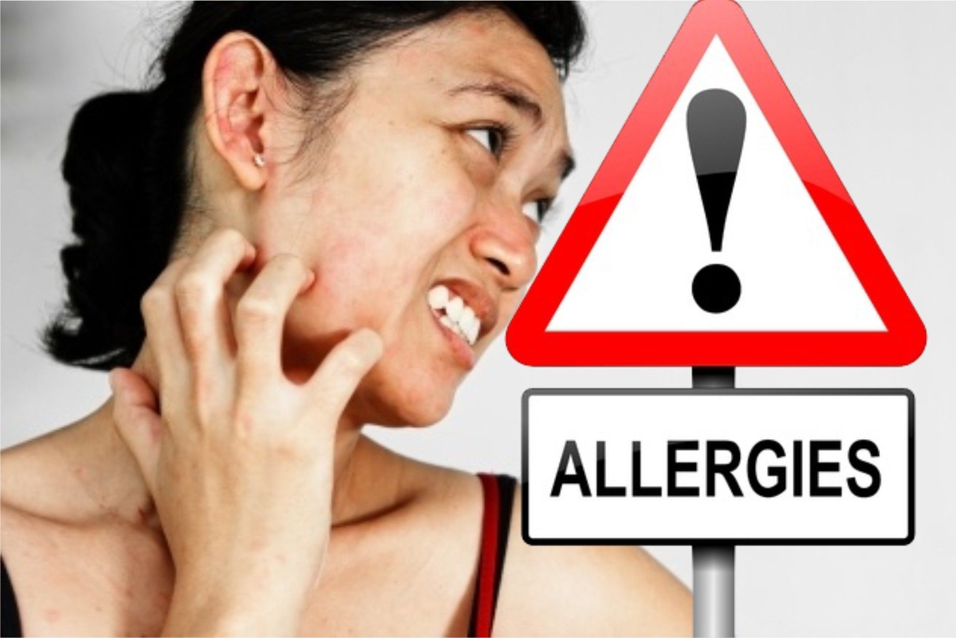 5 Pemicu Alergi Teraneh