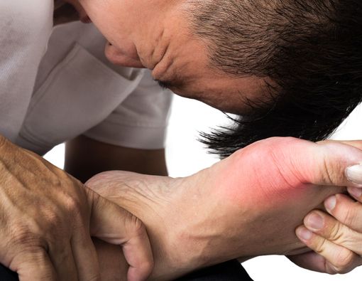 Penyebab Asam Urat Sering Kambuh di Malam Hari