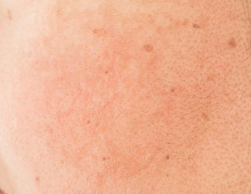 Mengenal Fakta dan Fungsi Pori-pori Kulit