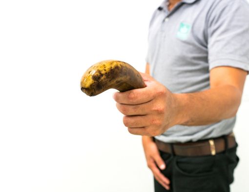 Inilah Penyebab Penis Bernanah dan Cara Mengobatinya