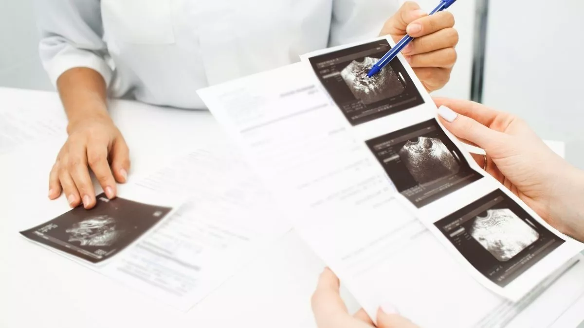 Wajib Tahu, Ini Perbedaan Kanker Ovarium dan Kista Ovarium