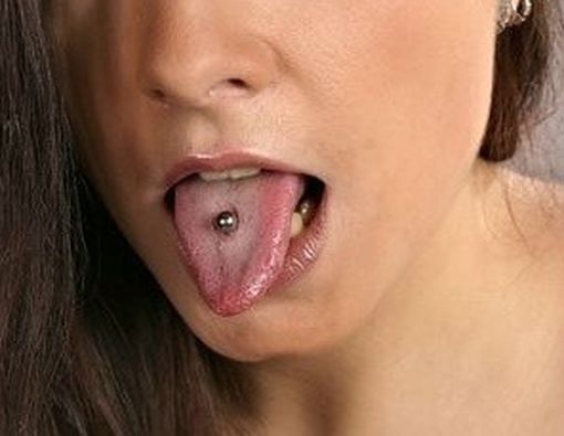 Risiko dari Tindik di Lidah