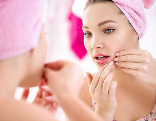 Kenapa Kulit Mudah Timbul Jerawat saat Haid?