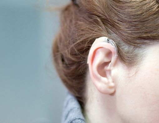 Antara Implan Koklea dan Alat Bantu Dengar, Mana Lebih Baik?