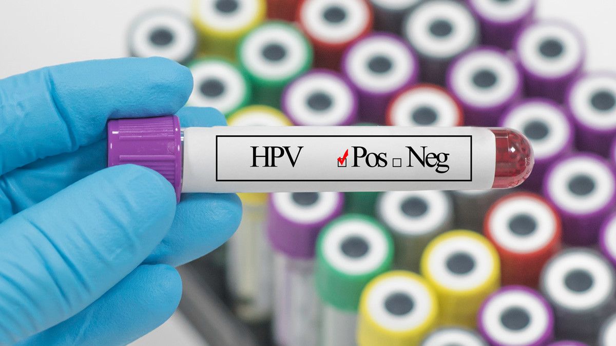 Positif HPV, Apakah Pasti Positif Kanker Serviks Juga? - KlikDokter
