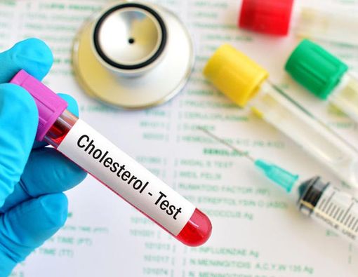 Periksa Kolesterol Sendiri vs. Periksa di Laboratorium?