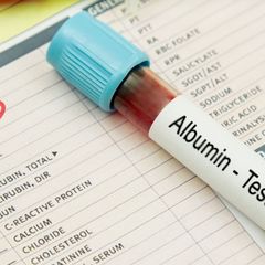 Qizi jinsiy aloqani orgatadi