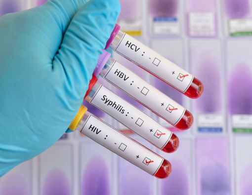 4 Daftar Infeksi Menular Seksual yang Sangat Berbahaya