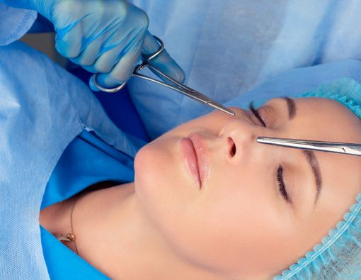 Ubah Bentuk Hidung, Kenali Operasi Rhinoplasty